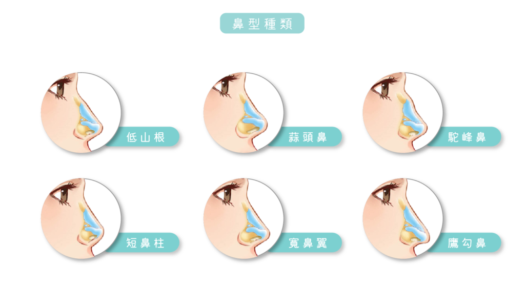 【美麗見證|三段式隆鼻】精緻鼻型成就五官 - 葛鎂診所