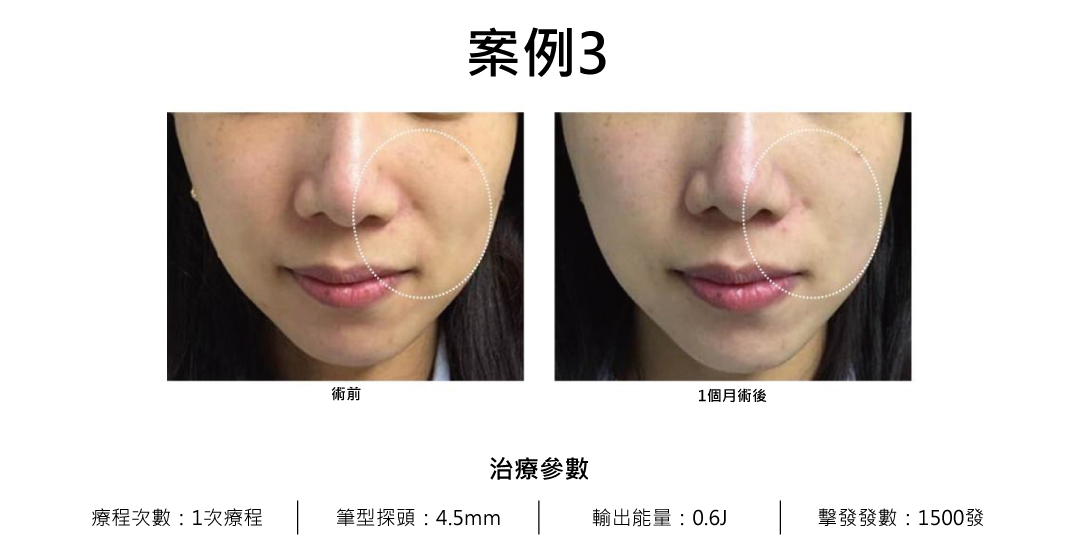 11 - 葛鎂診所